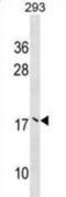 Ubiquitin Conjugating Enzyme E2 V2 antibody, abx029357, Abbexa, Western Blot image 
