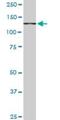 Cullin Associated And Neddylation Dissociated 1 antibody, H00055832-M05, Novus Biologicals, Western Blot image 