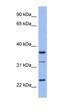 SRY-Box 21 antibody, orb329609, Biorbyt, Western Blot image 