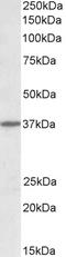 Cell Adhesion Molecule 1 antibody, STJ72327, St John