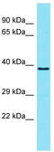 Transmembrane Protein 121 antibody, TA330772, Origene, Western Blot image 