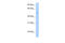 Telomeric Repeat Binding Factor 2 antibody, 27-304, ProSci, Western Blot image 