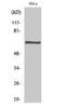 Protein Phosphatase 2 Scaffold Subunit Abeta antibody, STJ95191, St John