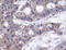Stathmin 1 antibody, LS-C335889, Lifespan Biosciences, Immunohistochemistry paraffin image 