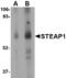 STEAP Family Member 1 antibody, TA306463, Origene, Western Blot image 