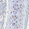 Cartilage Oligomeric Matrix Protein antibody, LS-C748978, Lifespan Biosciences, Immunohistochemistry frozen image 