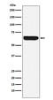 PLAP-1 antibody, M01718-3, Boster Biological Technology, Western Blot image 