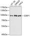 Structure Specific Recognition Protein 1 antibody, GTX54690, GeneTex, Western Blot image 