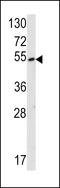 Lysine Methyltransferase 5C antibody, LS-C99227, Lifespan Biosciences, Western Blot image 