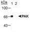 Alpha-PAK antibody, NB100-723, Novus Biologicals, Western Blot image 