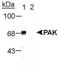 Serine/threonine-protein kinase PAK 1 antibody, NB100-723, Novus Biologicals, Western Blot image 