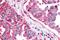 Serum/Glucocorticoid Regulated Kinase 2 antibody, NBP2-29393, Novus Biologicals, Immunohistochemistry paraffin image 