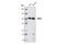 MutS Homolog 2 antibody, 2017P, Cell Signaling Technology, Western Blot image 