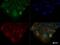 MET antibody, NBP2-44306, Novus Biologicals, Immunofluorescence image 