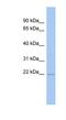 RWD Domain Containing 4 antibody, NBP1-56731, Novus Biologicals, Western Blot image 