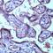 TIMP Metallopeptidase Inhibitor 3 antibody, PA5-32621, Invitrogen Antibodies, Immunohistochemistry paraffin image 