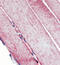 Superoxide Dismutase 2 antibody, GTX13533, GeneTex, Immunohistochemistry paraffin image 