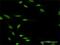 Zinc Finger Protein 71 antibody, H00058491-D01P, Novus Biologicals, Immunofluorescence image 