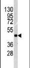 Integrin Linked Kinase antibody, PA5-14684, Invitrogen Antibodies, Western Blot image 