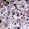 Apurinic/Apyrimidinic Endodeoxyribonuclease 1 antibody, LS-C351836, Lifespan Biosciences, Immunohistochemistry paraffin image 