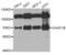 Chromatin Assembly Factor 1 Subunit B antibody, abx004781, Abbexa, Western Blot image 