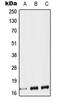 Tachykinin Precursor 1 antibody, MBS820753, MyBioSource, Western Blot image 