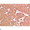 ATM Serine/Threonine Kinase antibody, LS-C813191, Lifespan Biosciences, Immunohistochemistry paraffin image 