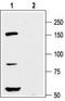 Potassium Voltage-Gated Channel Subfamily H Member 8 antibody, TA328970, Origene, Western Blot image 