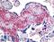 Neuroepithelial Cell Transforming 1 antibody, LS-A3412, Lifespan Biosciences, Immunohistochemistry paraffin image 