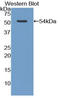 Adiponectin Receptor 2 antibody, LS-C298210, Lifespan Biosciences, Western Blot image 