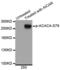 Acetyl-CoA Carboxylase Alpha antibody, MBS128396, MyBioSource, Western Blot image 