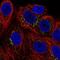 Protein O-Mannosyltransferase 1 antibody, NBP2-57200, Novus Biologicals, Immunofluorescence image 