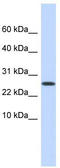 Podoplanin antibody, TA335683, Origene, Western Blot image 