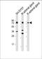 Dopamine Beta-Hydroxylase antibody, A01110-2, Boster Biological Technology, Western Blot image 