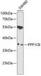Protein Phosphatase 1 Catalytic Subunit Beta antibody, 15-047, ProSci, Western Blot image 