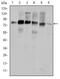 Cortactin antibody, MA5-15831, Invitrogen Antibodies, Western Blot image 