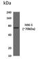 Serine Peptidase Inhibitor, Kunitz Type 1 antibody, NBP2-12356, Novus Biologicals, Western Blot image 