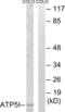ATP Synthase Membrane Subunit E antibody, LS-C119751, Lifespan Biosciences, Western Blot image 