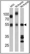 Thyroid Hormone Receptor Alpha antibody, PA1-211A, Invitrogen Antibodies, Western Blot image 