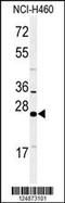 RAB27B, Member RAS Oncogene Family antibody, 61-743, ProSci, Western Blot image 