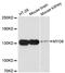 Myosin VI antibody, LS-C748097, Lifespan Biosciences, Western Blot image 