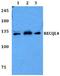 RecQ Like Helicase 4 antibody, A03130, Boster Biological Technology, Western Blot image 