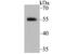Retinoid X Receptor Alpha antibody, A01299, Boster Biological Technology, Western Blot image 