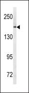 ATP Binding Cassette Subfamily C Member 1 antibody, PA5-13543, Invitrogen Antibodies, Western Blot image 