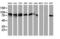 Protein Kinase C Epsilon antibody, LS-C337258, Lifespan Biosciences, Western Blot image 