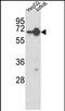 Heterogeneous nuclear ribonucleoprotein L antibody, PA5-72368, Invitrogen Antibodies, Western Blot image 