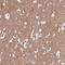 FKBP Prolyl Isomerase 8 antibody, HPA045177, Atlas Antibodies, Immunohistochemistry paraffin image 