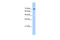 LAS1 Like, Ribosome Biogenesis Factor antibody, 28-150, ProSci, Enzyme Linked Immunosorbent Assay image 