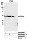 Ubiquitin carboxyl-terminal hydrolase 4 antibody, A300-830A, Bethyl Labs, Immunoprecipitation image 