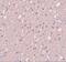 Signal Induced Proliferation Associated 1 Like 3 antibody, NBP2-81902, Novus Biologicals, Immunohistochemistry paraffin image 